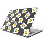 UV Printed Pattern Laptop Frosted Protective Case, For MacBook Air 11.6 A1370 / A1465, For MacBook Pro 13.3 A1278