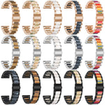 xDfind Three Beads Metal Resin Watch Band, For Fitbit Versa 4 / 3 / Sense 2 / Sense