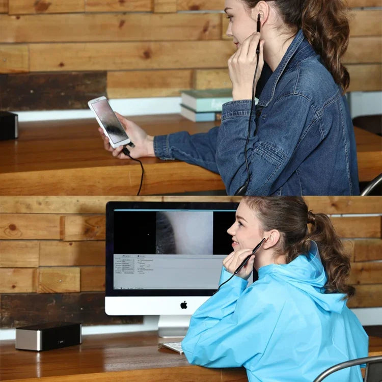 i96 3 in 1 USB Ear Scope Inspection HD 0.3MP Camera Visual Ear Spoon for OTG Android Phones & PC & MacBook, 1.85m Length Cable, 3 in 1 Black  0.3MP